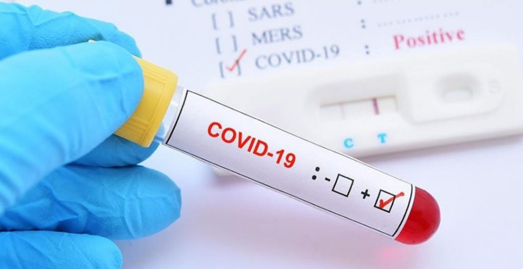 मकवानपुरमा आज २२ जनामा कोरोना संक्रमण पुष्ठि