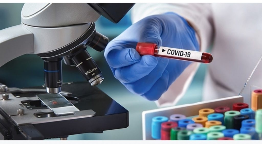 मकवानपुरगढीमा हालसम्म २२ जना कोरोना संक्रमित मध्ये १६ जना संक्रमण मुक्त