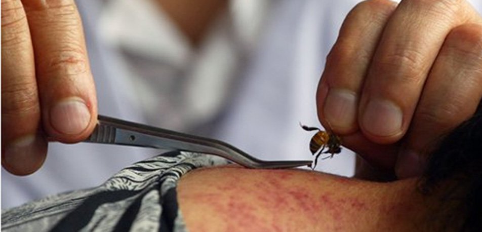 ढाडकाे दुःखाइ लगायतका रोगको उपचारमा मौरी थेरापी प्रभावकारी