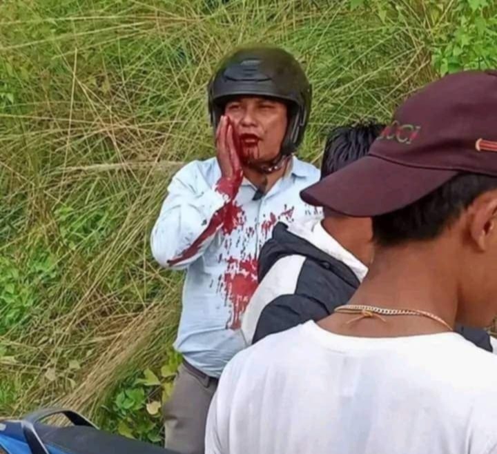 मकवानपुरका एक शिक्षकमाथि गोली प्रहार